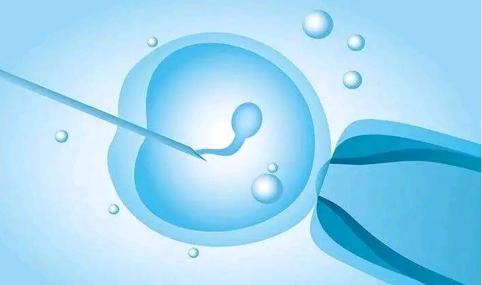 哈尔滨湘雅附一生殖中心做试管婴儿取卵会打麻药吗？
