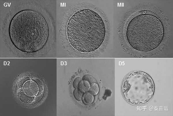 三代试管中胚胎碎片是判断胚胎好坏的一个重要标志-眼睑缘炎
